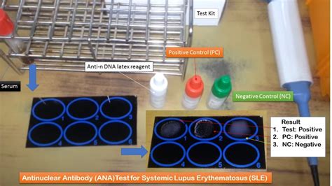 ana elisa test